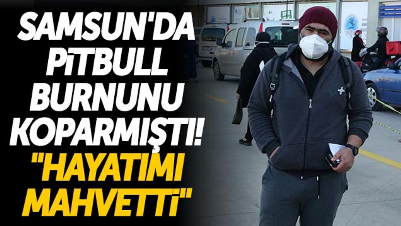 Samsun'da Pitbull Burnunu Koparmıştı! 'Hayatımı Mahvetti'