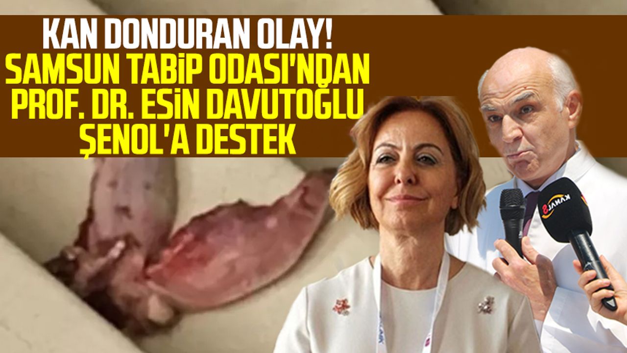 Kan donduran olay! Samsun Tabip Odası'ndan Prof. Dr. Esin Davutoğlu Şenol'a destek