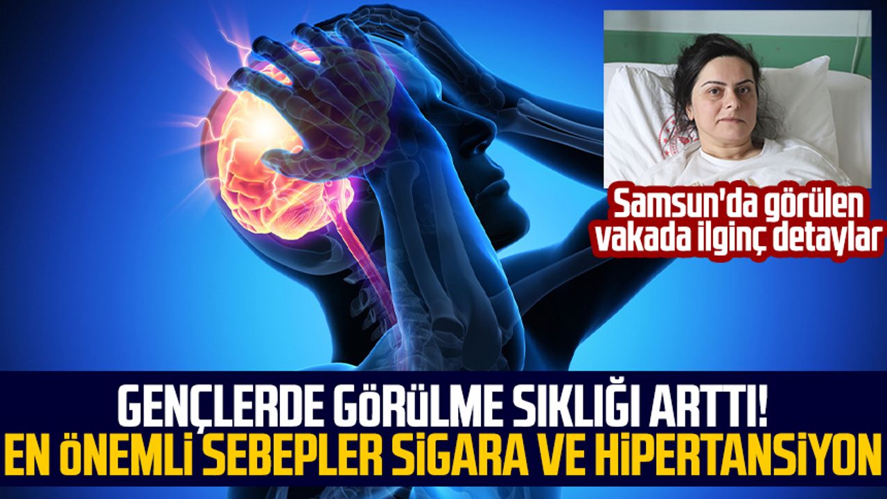 Samsun'da görülen vakada ilginç detaylar: Gençlerde görülme sıklığı arttı! En önemli sebepler sigara ve hipertansiyon