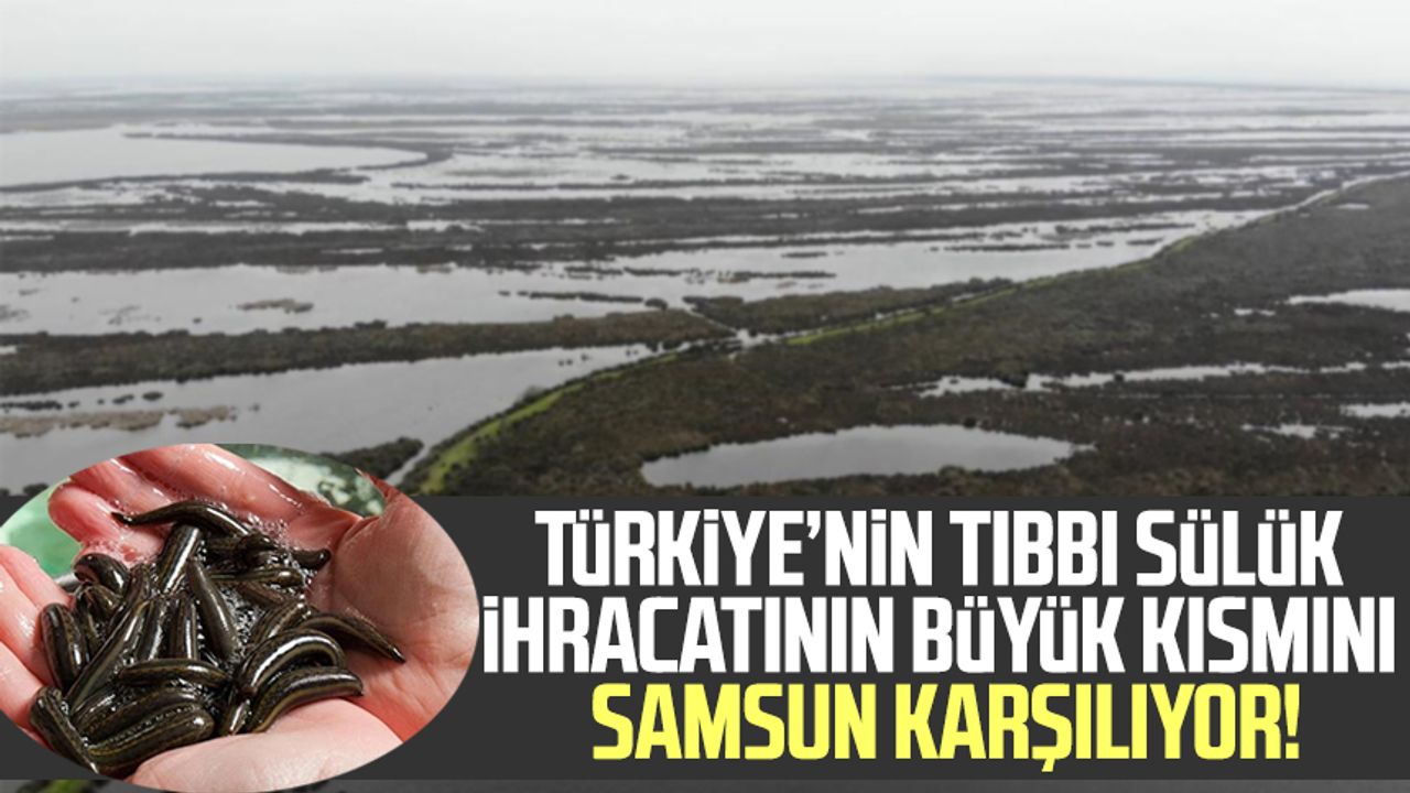Türkiye’nin tıbbi sülük ihracatının büyük kısmını Samsun karşılıyor!