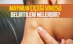 Maymun Çiçeği Virüsü Belirtileri Nelerdir?