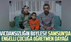 Vicdansızlığın böylesi! Samsun'da engelli çocuğa öğretmen dayağı