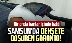 Samsun'da dehşete düşüren görüntü! Bir anda kanlar içinde kaldı