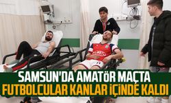 Samsun'da amatör maçta futbolcular kanlar içinde kaldı