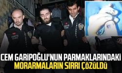 Dikkat çekmişti: Cem Garipoğlu'nun parmaklarındaki morarmaların sırrı çözüldü