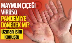 Maymun Çiçeği virüsü pandemiye dönecek mi? Uzman isim konuştu