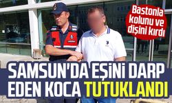 Samsun'da eşini darp edip kolunu ve dişini kıran koca tutuklandı