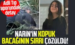 Narin'in kopuk bacağının sırrı çözüldü!