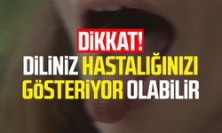 Dikkat! Diliniz hastalığınızı gösteriyor olabilir