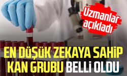 En düşük zekaya sahip kan grubu belli oldu: Uzmanlar açıkladı