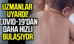 Uzmanlar uyardı! Covid-19'dan daha hızlı bulaşıyor