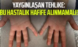 Yaygınlaşan tehlike: Bu hastalık hafife alınmamalı!