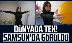 Dünyada tek! Samsun'da görüldü