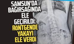 Samsun'da bağırsağında ele geçirildi: Röntgende yakayı ele verdi