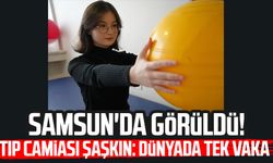 Samsun'da görüldü! Tıp camiası şaşkın: Dünyada tek vaka