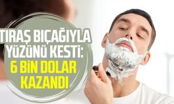 Tıraş bıçağıyla yüzünü kesti: 6 bin dolar kazandı