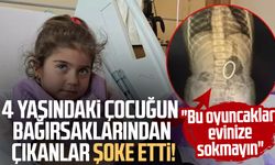 4 yaşındaki çocuğun bağırsaklarından çıkanlar şoke etti!
