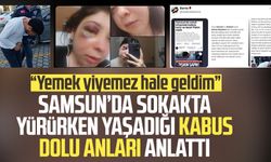 Samsun'da sokakta yürürken taciz ve darpa maruz kalan kadından destek çağrısı