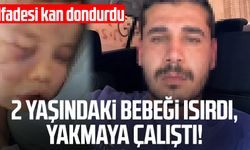 2 yaşındaki bebeği ısırdı, yakmaya çalıştı! İfadesi kan dondurdu