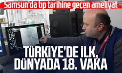 Samsun’da tıp tarihine geçen ameliyat: Türkiye’de ilk, dünyada 18. vaka