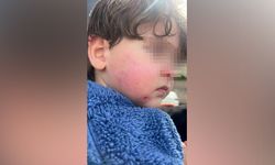 Kreşe bıraktığı çocuğunu darp edilmiş halde aldı!