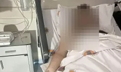 Ara sokakta dehşet! Genç kadın ölümden döndü