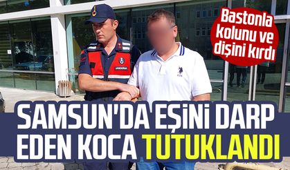 Samsun'da eşini darp edip kolunu ve dişini kıran koca tutuklandı