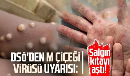 DSÖ'den M çiçeği virüsü uyarısı: Salgın kıtayı aştı!