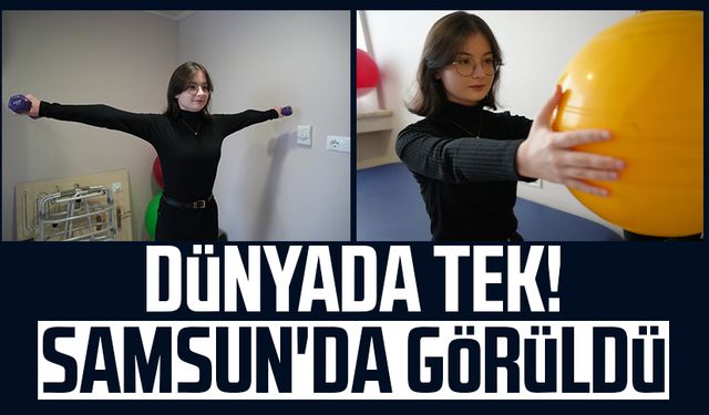 Dünyada tek! Samsun'da görüldü