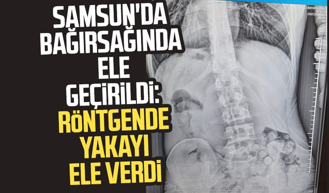 Samsun'da bağırsağında ele geçirildi: Röntgende yakayı ele verdi