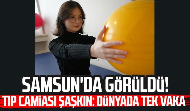 Samsun'da görüldü! Tıp camiası şaşkın: Dünyada tek vaka