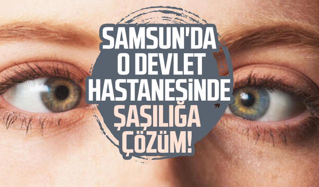 Samsun'da o devlet hastanesinde şaşılığa çözüm!