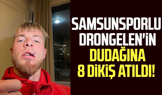 Samsunsporlu Van Drongelen'in dudağına 8 dikiş atıldı!