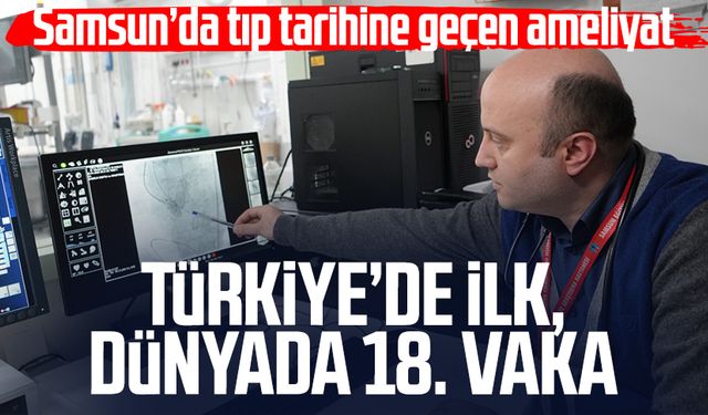 Samsun’da tıp tarihine geçen ameliyat: Türkiye’de ilk, dünyada 18. vaka