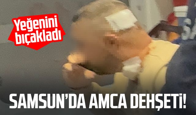 Samsun'da kanlı olay! Yeğenini bıçakladı