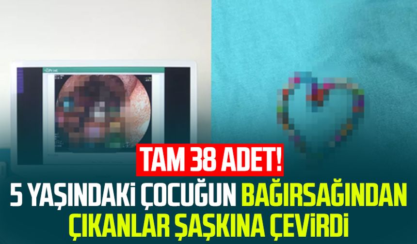 5 yaşındaki çocuğun bağırsağından çıkanlar şaşkına çevirdi: Tam 38 adet!