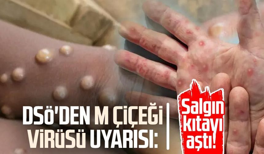 DSÖ'den M çiçeği virüsü uyarısı: Salgın kıtayı aştı!