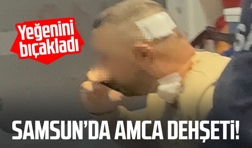 Samsun'da kanlı olay! Yeğenini bıçakladı