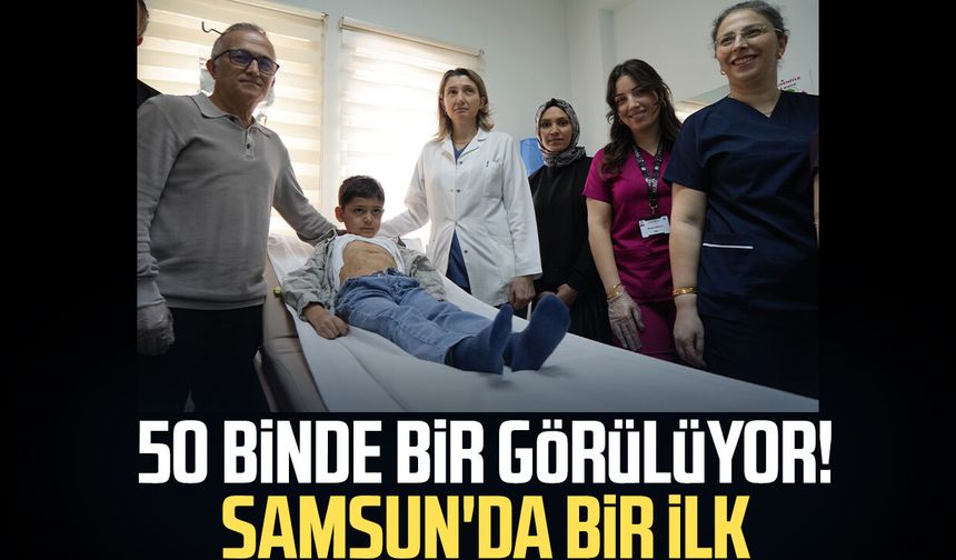 50 binde bir görülüyor! Samsun'da bir ilk - samsungazetesi.com