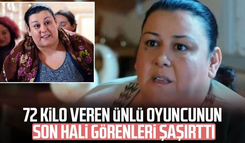 72 kilo veren Esin Gündoğdu'nun değişimi dikkat çekti