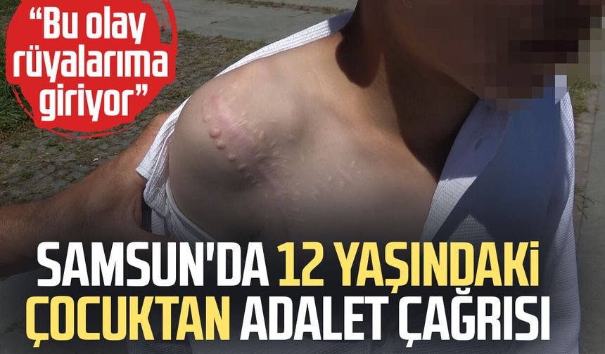 Samsun'da köpek saldırısına uğrayan Yunus adalet istiyor