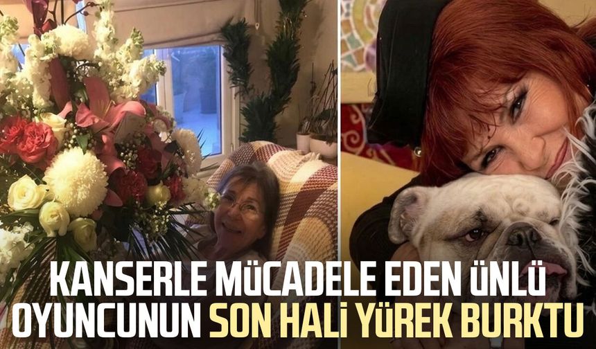 Ünlü oyuncu Gül Onat'ın son hali yürek burktu