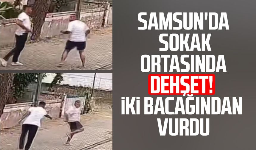Samsun'da sokak ortasında dehşet! İki bacağından vurdu