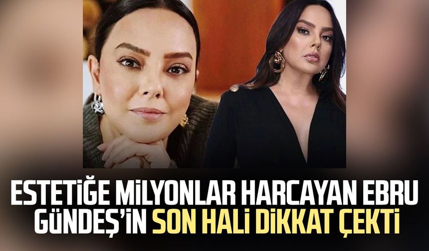 Estetiğe milyonlar harcayan Ebru Gündeş’in son hali dikkat çekti