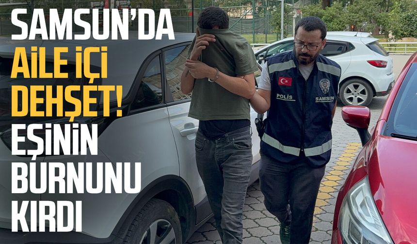 Samsun’da eşini darbedip burnunu kırdığı iddia edilen koca tutuklandı