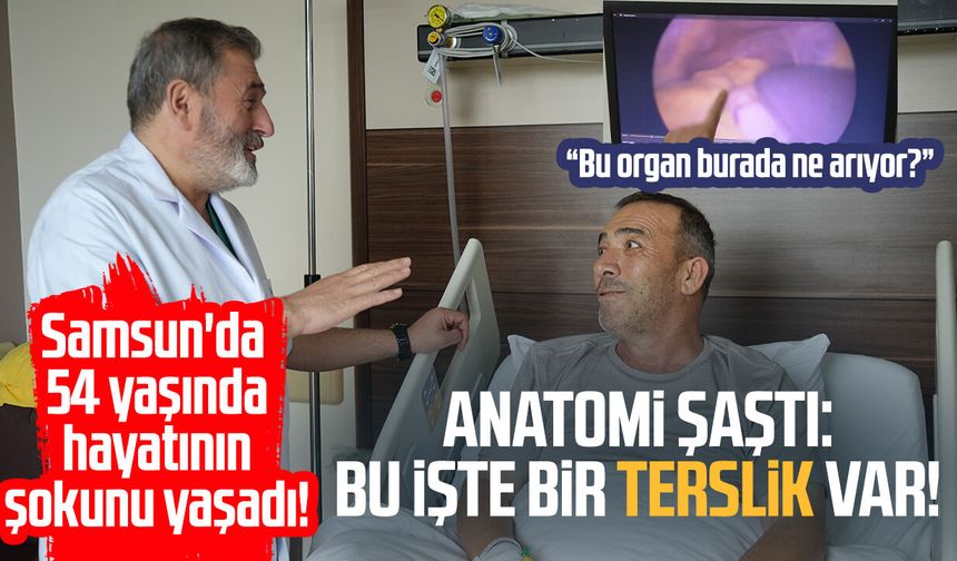 Samsun’da doktorları şaşırtan vaka! Organları ters çıktı