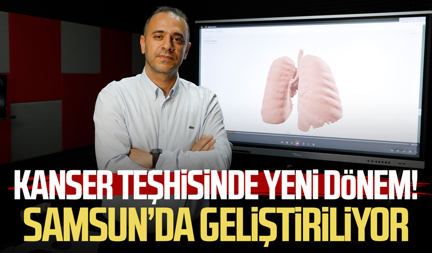 Kanser teşhisinde yeni dönem! Samsun’da geliştiriliyor