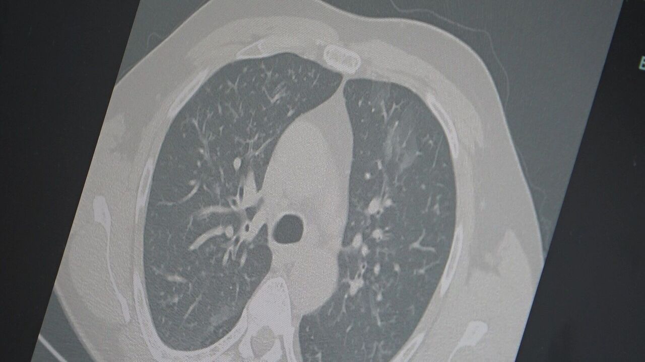 Samsun'da salgın alarmı: "3'lü virüse dikkat"