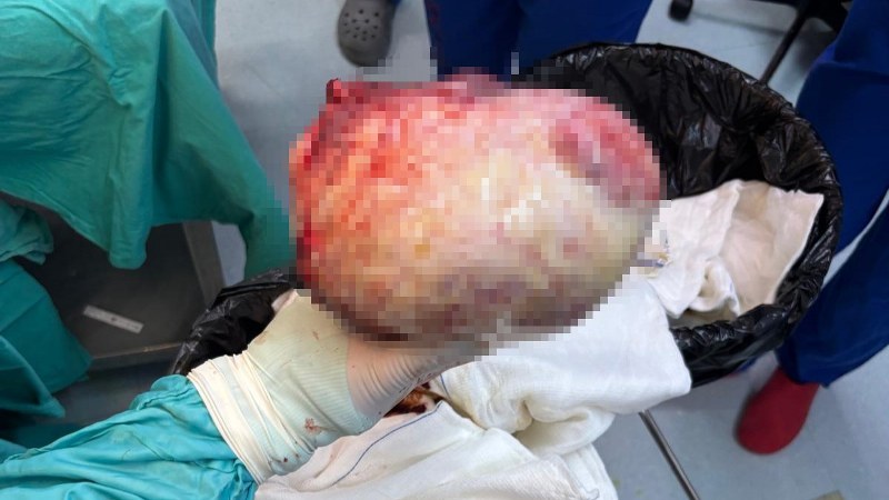 Karadeniz'de şaşkına çeviren vaka! 60 yaşında kendine 'hamile' sanıyordu!