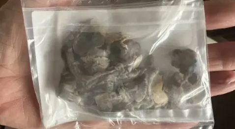 Hastaneye zor yetiştirdiler, öğrendikleri gerçekle yıkıldılar